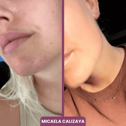 2x1 BÁLSAMO + 10 MASCARILLAS GRATIS