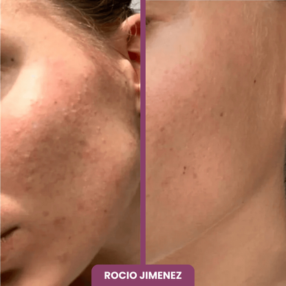 2x1 BÁLSAMO + 10 MASCARILLAS GRATIS