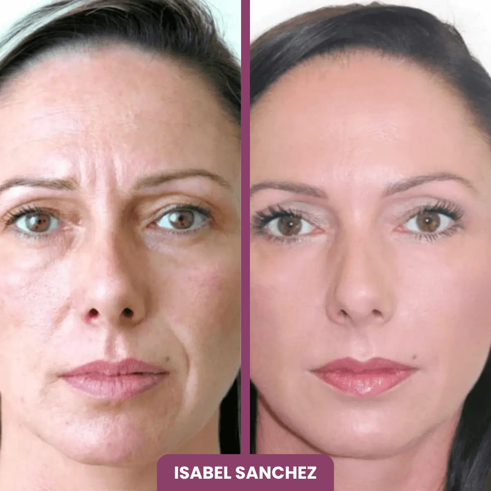 2x1 BÁLSAMO + 10 MASCARILLAS GRATIS