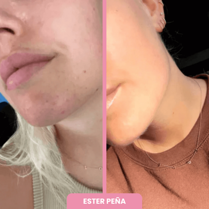 OFERTA 2x1 + BROCHA REGALO | Máscara de Colágeno Coreana 🇰🇷